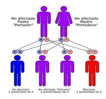 s&iacute;ndrome de Menkes
