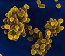 Brucella 63 la brucella