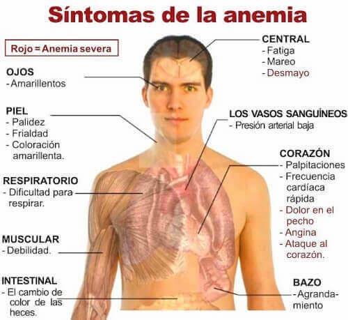 s&iacute;ntomas anemia