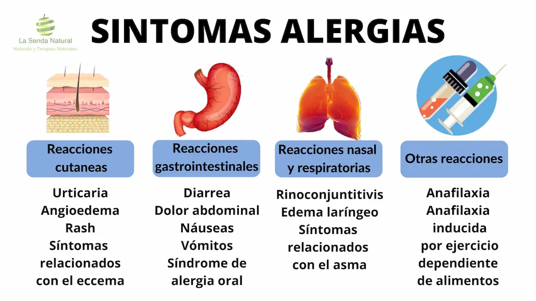 S&iacute;ntomas de las alergias