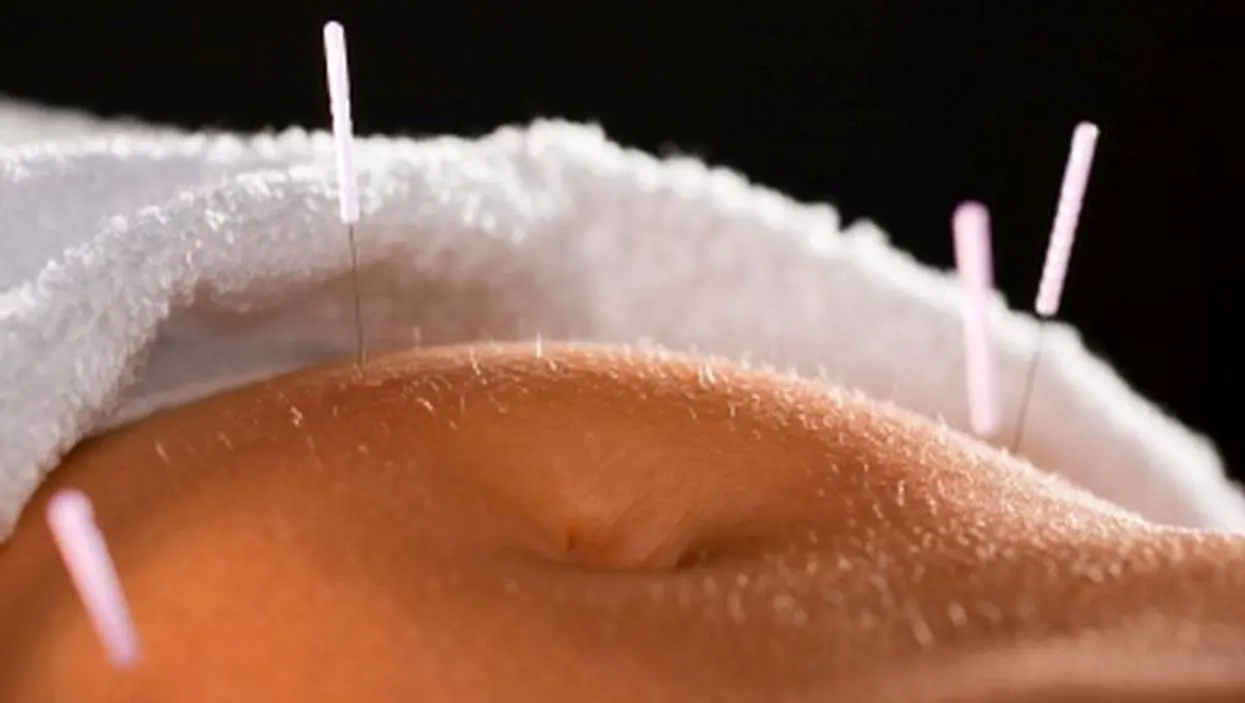 Soluci&oacute;n natural para la endometriosis