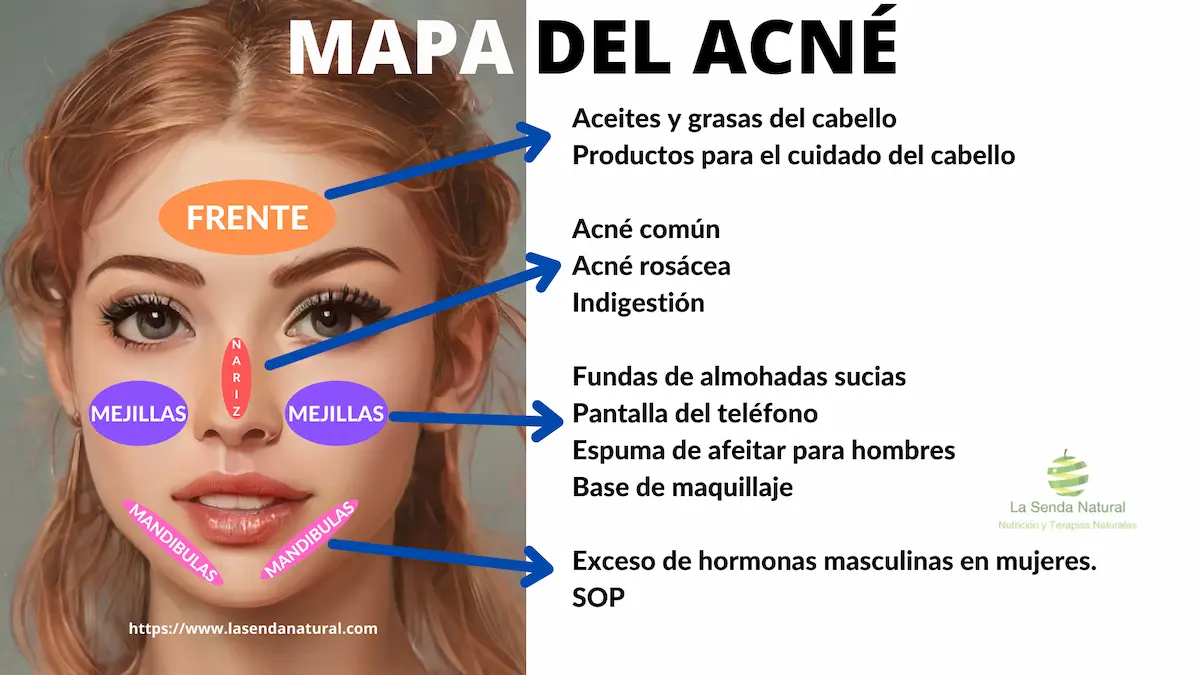 mapeo del acn&eacute;