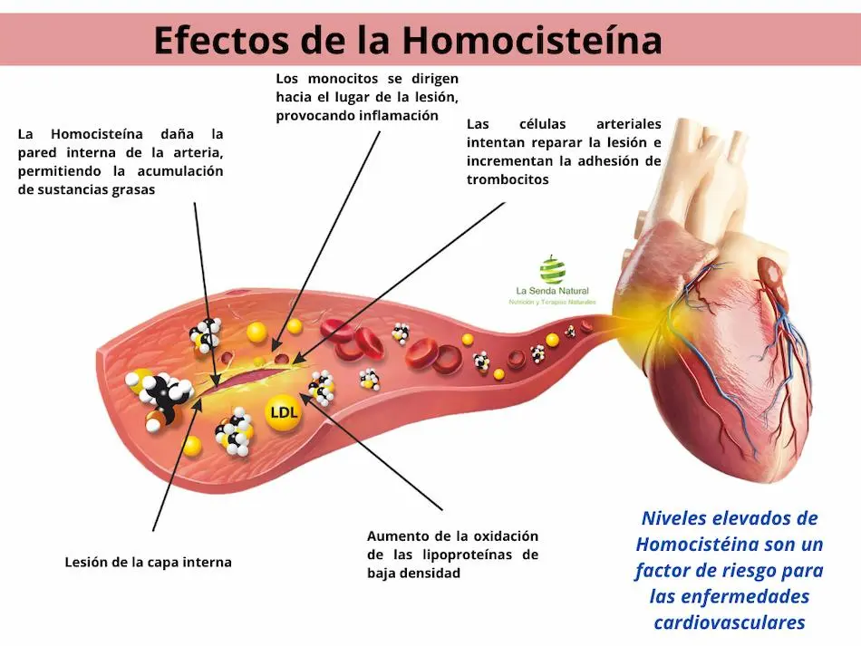 Efectos de la Homociste&iacute;na